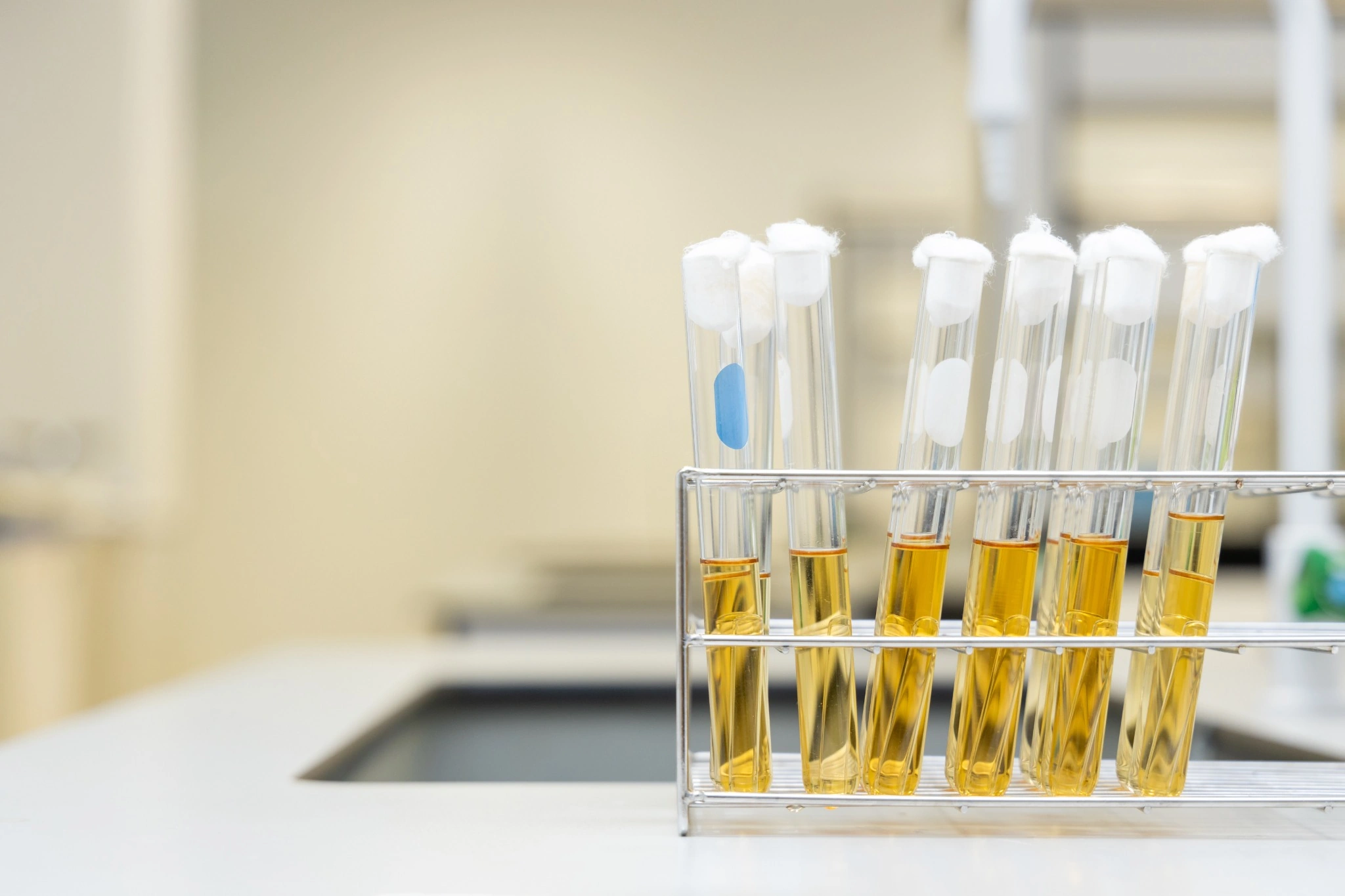 Laboratory test tubes containing water samples used to test for coliform bacteria and E. coli in well water